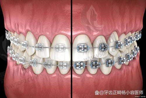德康口腔医院：平湖地区牙科新动力