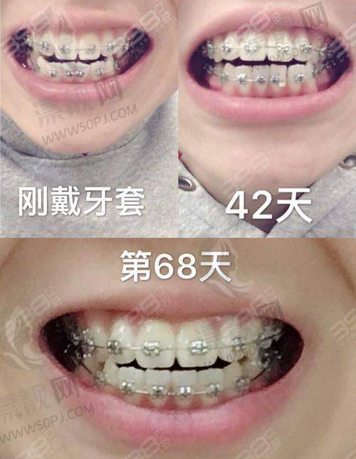 2. 福州登特口腔医院（楼层大、看牙便捷）