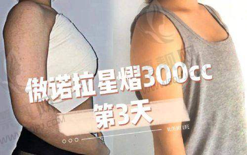 口碑见证:顾客满意是王道