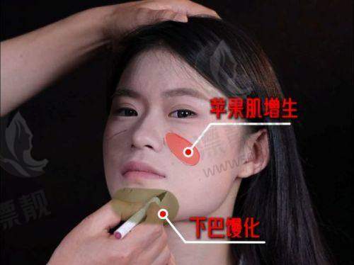 东莞隆胸哪家医院好？排名前三的东莞人民医院、广医附东莞一院、美立方医美别错过！