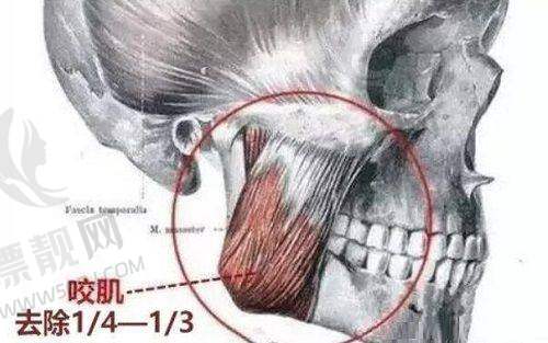 【真人实例库】那些年付毅雕刻的