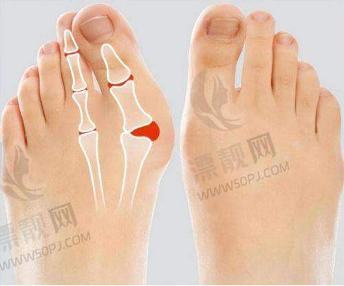 选择指南:什么样的眼睛需要修复?