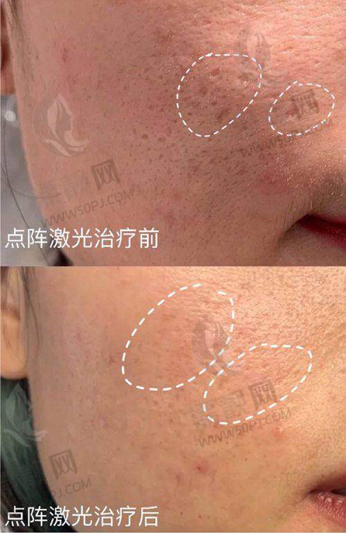 李信峰医生是什么级别？深圳鼻整形专家案例解析与医院地址全揭秘