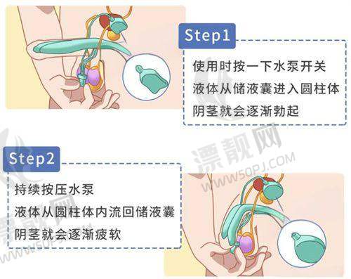 美诗沁专业去眼袋：微创、不开刀去眼袋价格表大揭秘，让你告别“泡泡眼”！