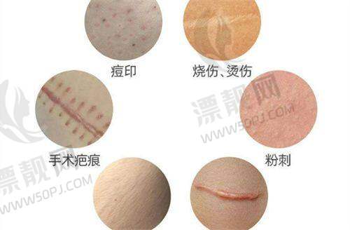 从医学校讲师到技术流名咖的蜕变