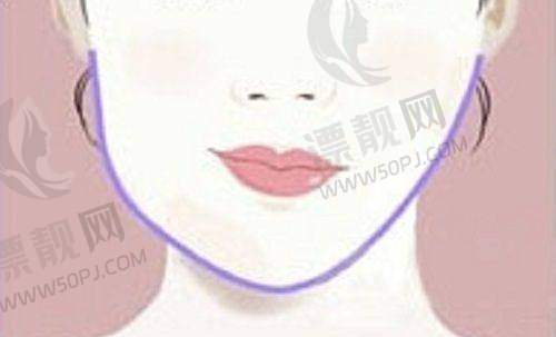 费用透明度