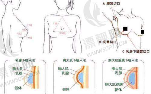 专精技术特色大揭秘