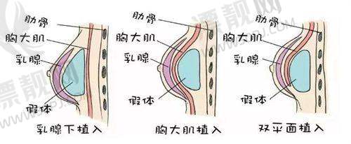 英伦大提升的优势总结