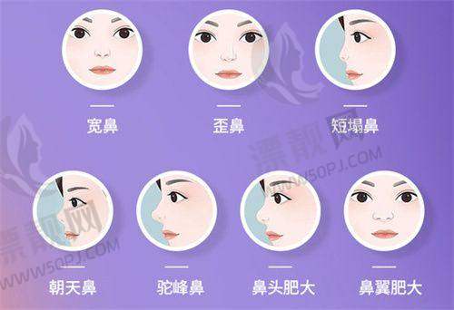 深圳李信锋做的手术怎么样？3000+真实实例说话