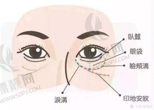 TOP3:丁翔医生 - 长沙专精整形医院