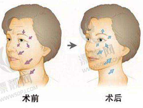 临床成效数据说话