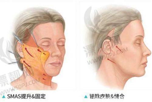 昆明第一人民医院星耀医院整形科的口碑与评价