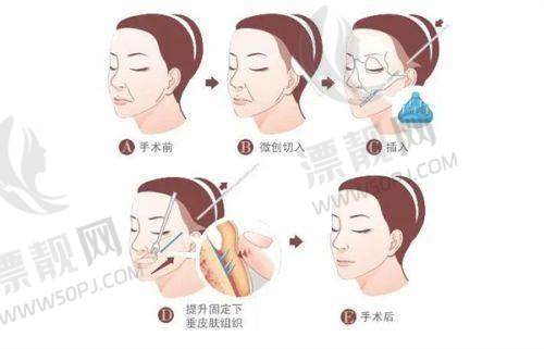 适合人群