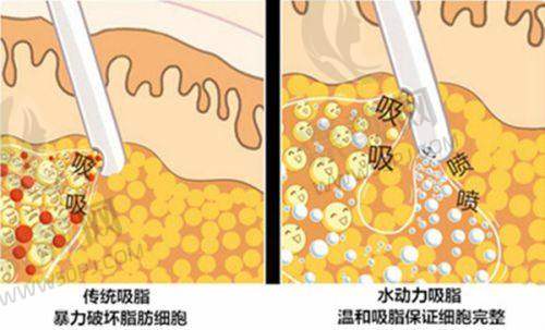 版本不同，价格有别