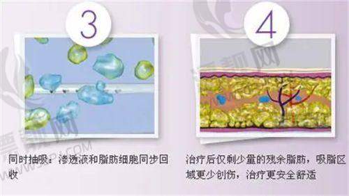 第一名:东莞市人民医院烧伤整形外科