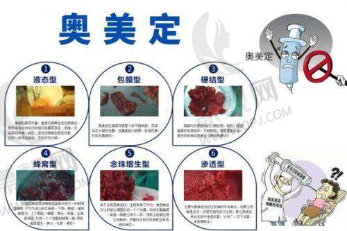 热门医美项目分析:满足不同需求