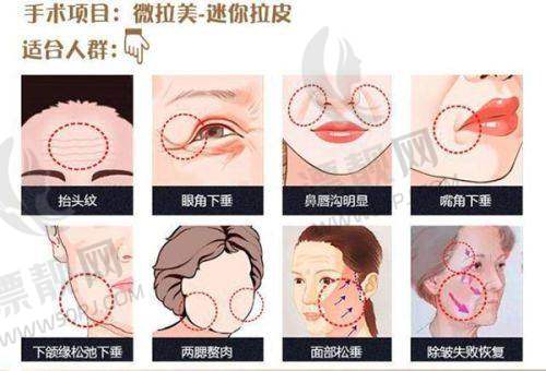 生物补片的功能特点
