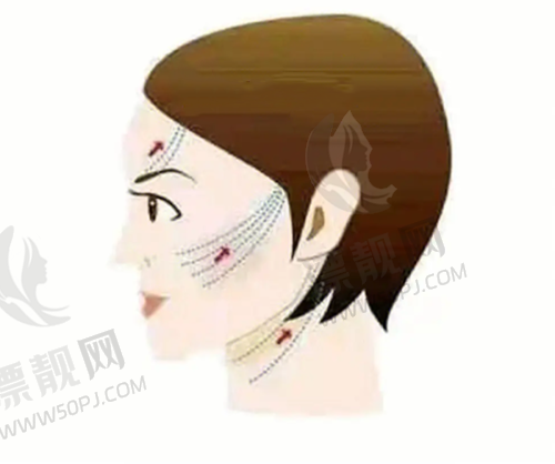 热超联合适用的问题