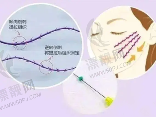 适用人群与功效对比:各有所长,按需选择