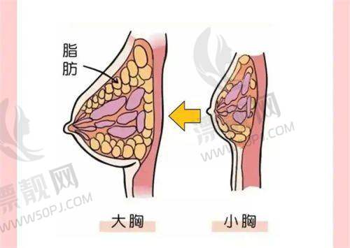 富贵包手术价格参考与选择建议