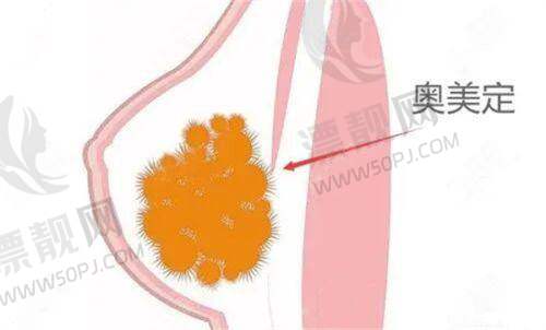北京哪里打濡白天使好？北京协和、北医三院、伊美尔排名靠前值得选！