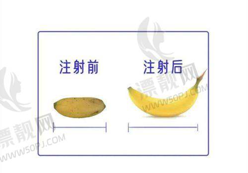 胸部整形价格及优势