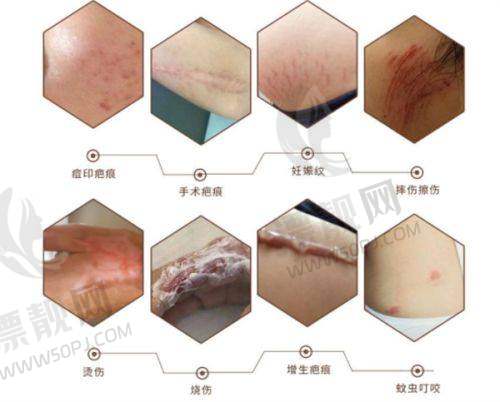 注意事项:细节决定成败
