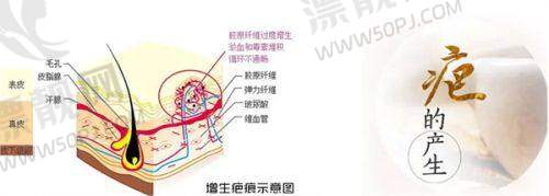 长沙注射物取出医生名单最新！2025排名前三：李成、杨建国、丁翔医生实力揭秘！