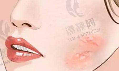 西安整形项目价格参考