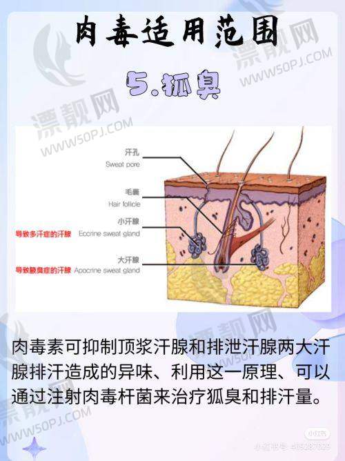天玑天使针价格的注意事项