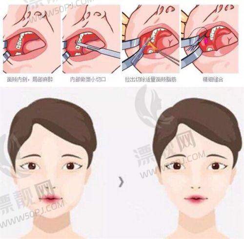眼部修复术后护理要点