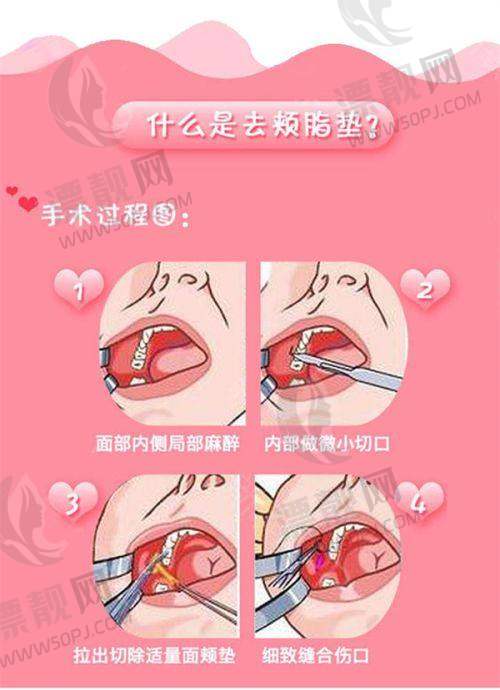 【术前早知道】面诊付毅医生的必备功课