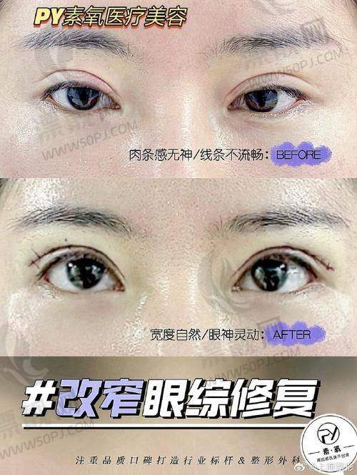 六、写在变得更美的路上：建议与Tips