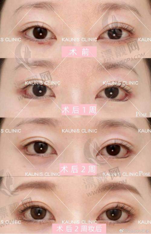 一、华美整形美容医院电话号码是多少？怎么预约？