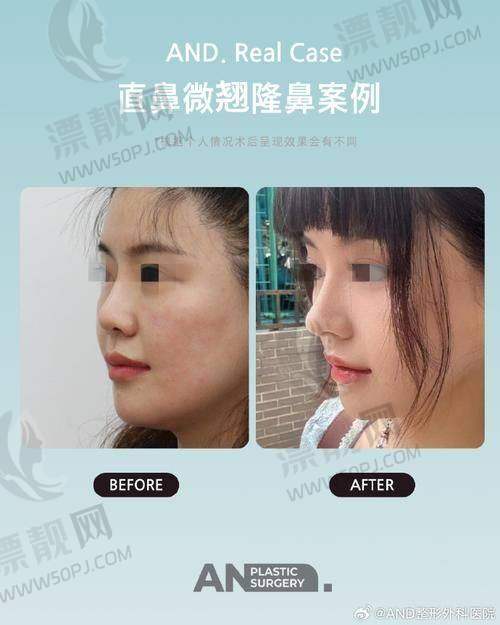 三、合肥华美整形医院有哪些项目？价格贵不贵？