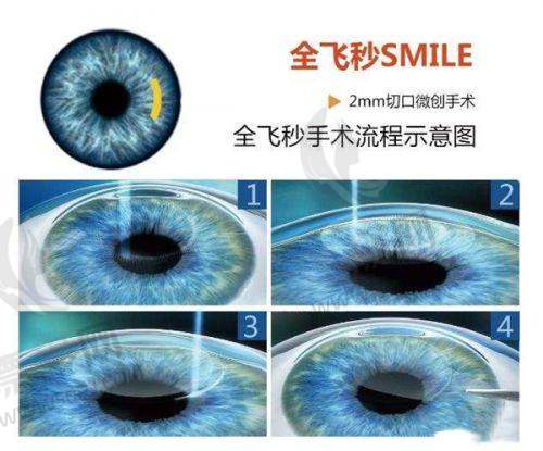 赣州启明星眼科地址与就诊时间