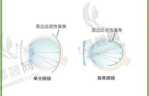 赣州爱尔眼科医院看什么病?开设哪些科室?