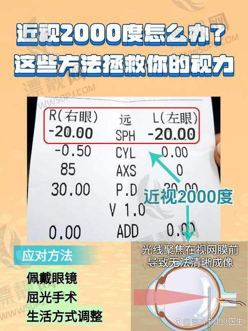 术后服务贴心,让每一位患者放心摘镜