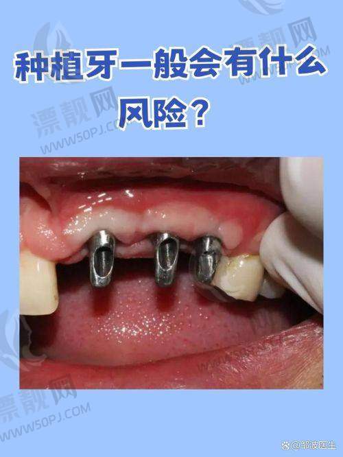 9. 康达盛口腔|种植与修复二合一