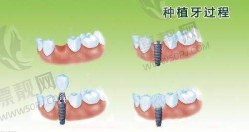 【结语】咸阳牙科医院选哪家？答案不止一个！
