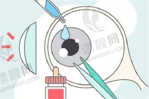 郑州视光眼科医院做近视手术怎么样？医生实力、服务质量为你一一解答！