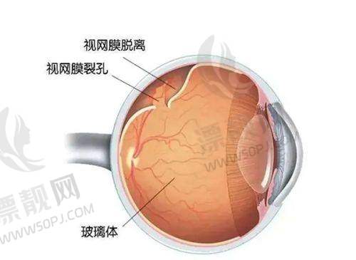 常州普瑞眼科医院地址在哪？附详细交通攻略、就诊流程及热门项目价格