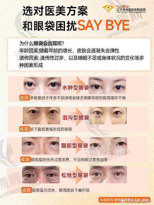 医生详解三：周小伟