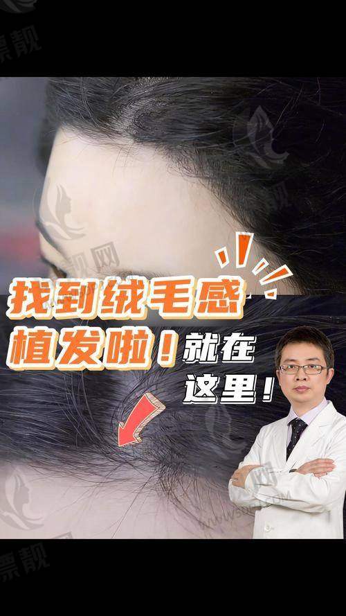 NO.10 成都丝恒植发