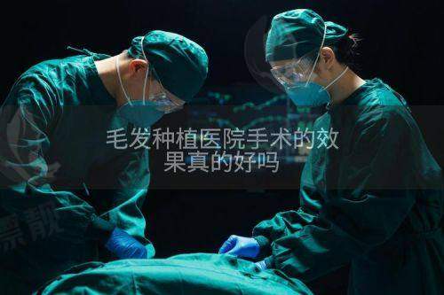NO.3 成都恒美植发