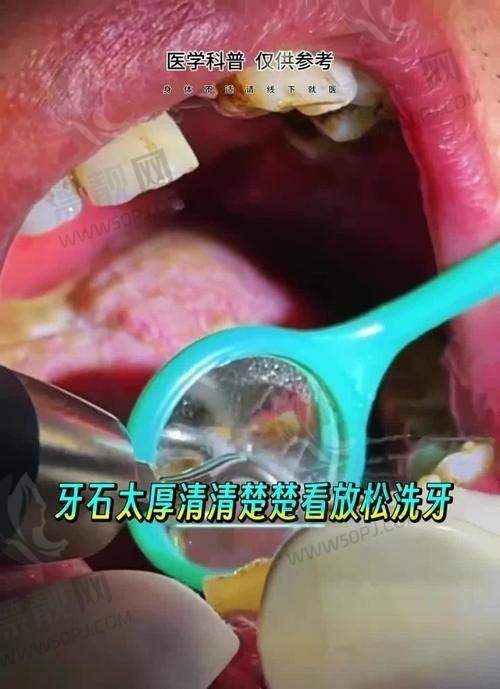 长春牙冠军口腔医院是正规医院吗？一探资质背景