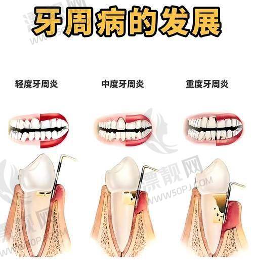 ?消费心智分析：为什么大家更信赖“临沂冠军”？