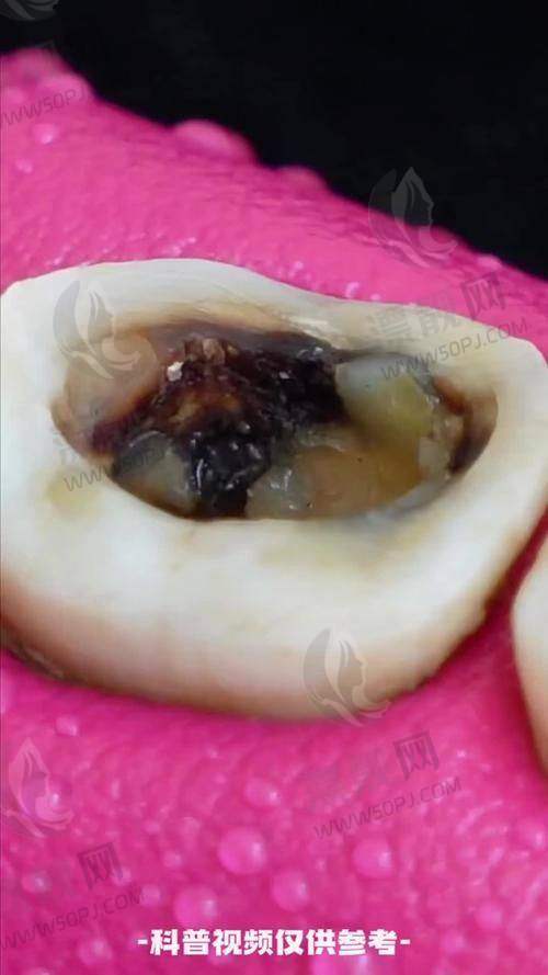 7. 南宁牙百年口腔