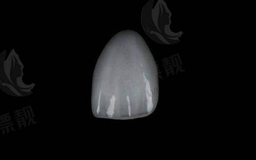 五、南宁悦美口腔——专为年轻人定制的审美型贴面机构