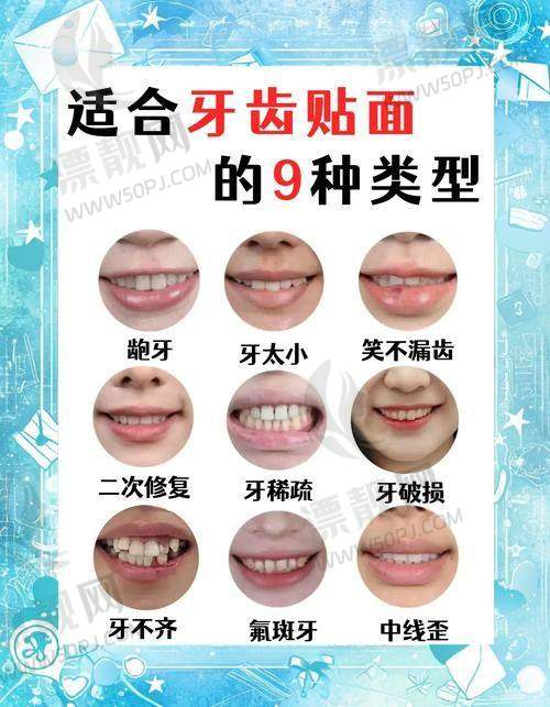 三、南宁诺贝尔口腔——有名连锁品牌，主打高端美学贴面